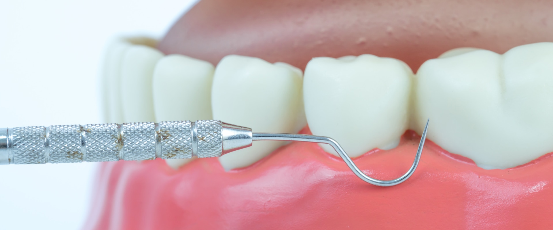 The Benefits and Risks of Using Ultrasonic Dental Scalers in Dentistry