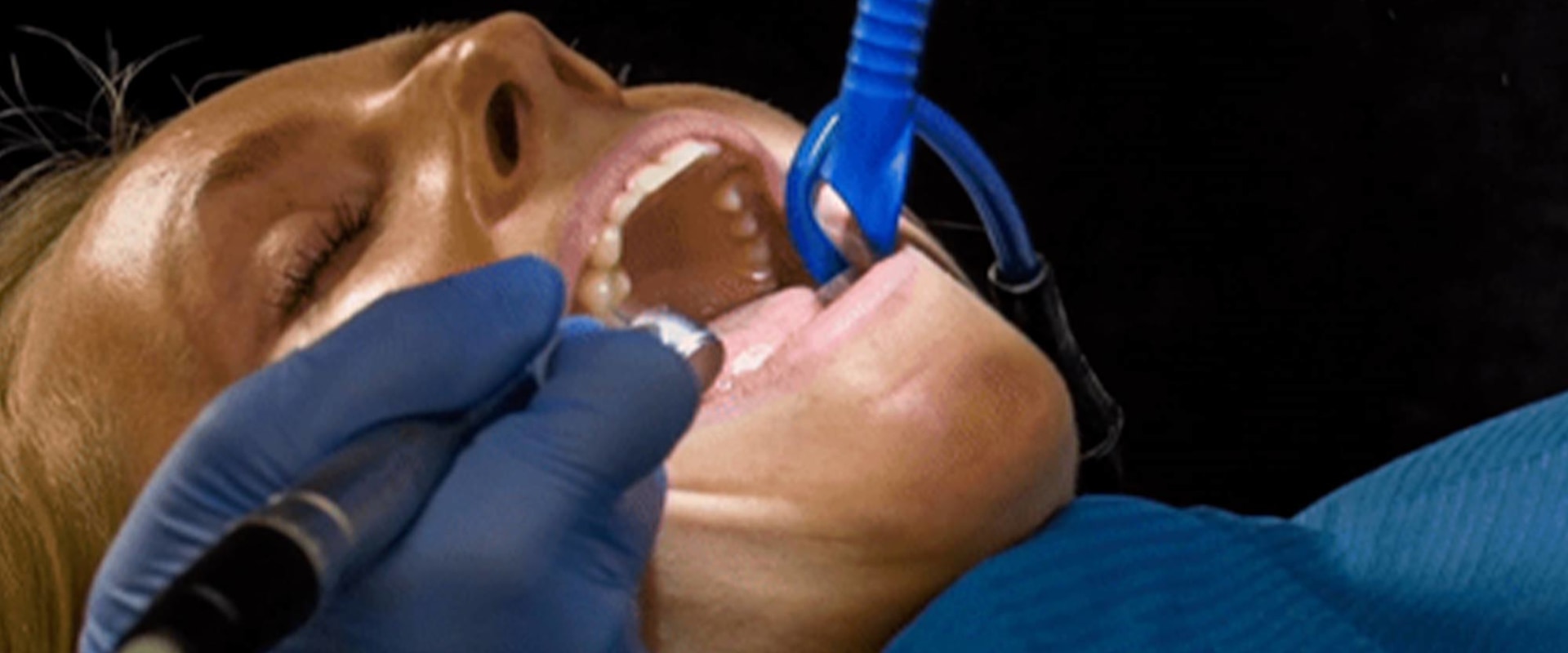 4 Reasons Why Your Dentist Uses Dental Suction Devices
