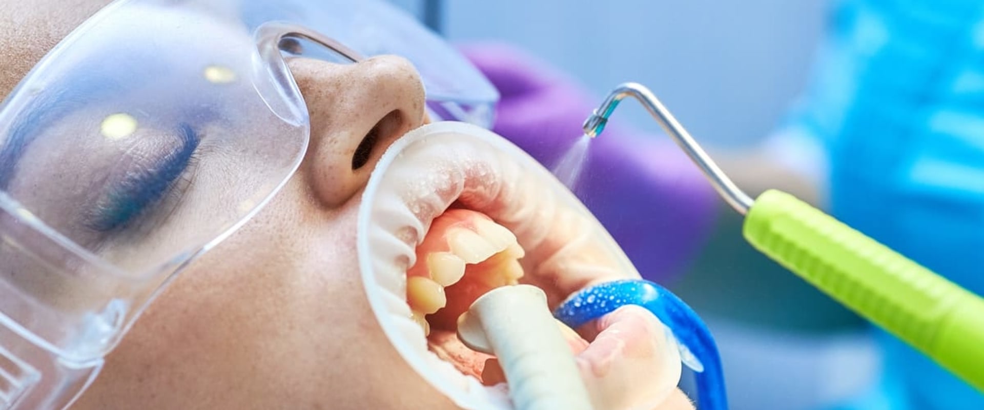 The Advantages of Air Abrasion Devices in Dentistry