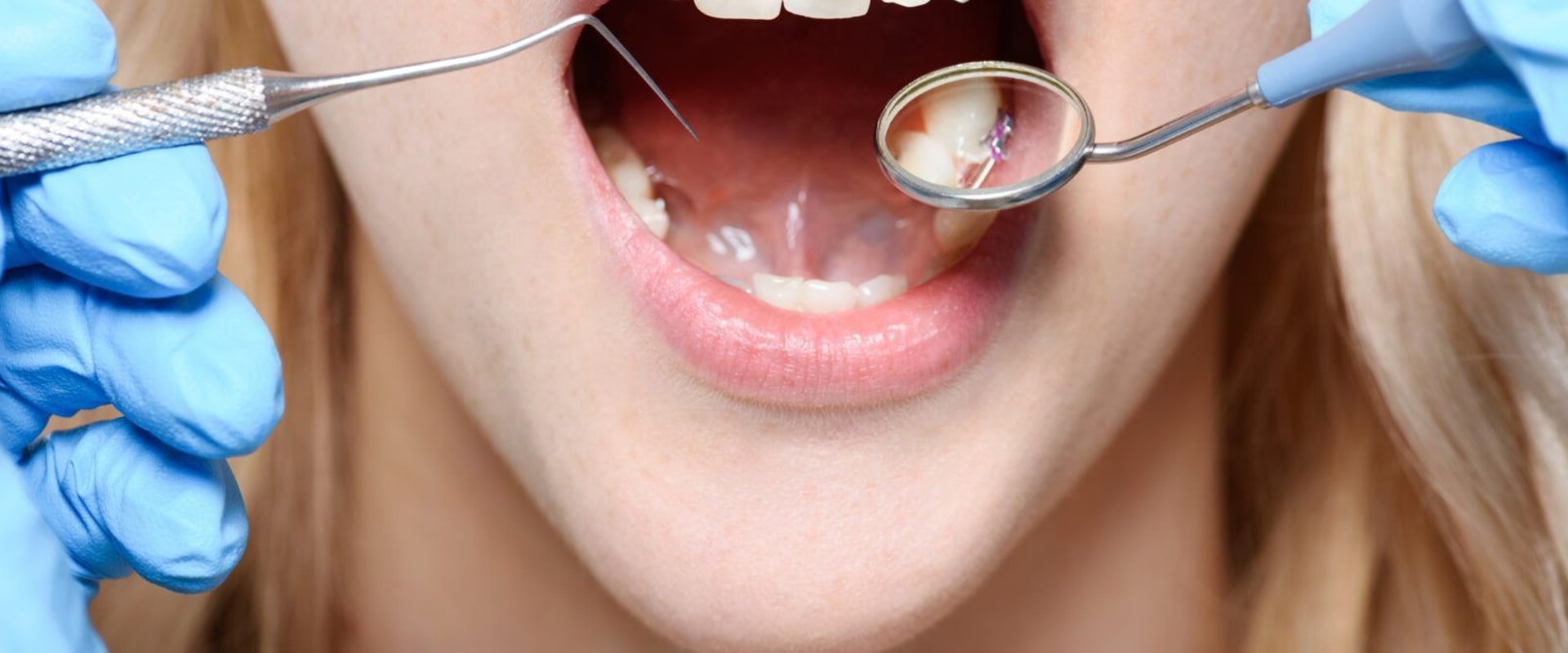What is a Dental Mirror Used For? - An Expert's Guide