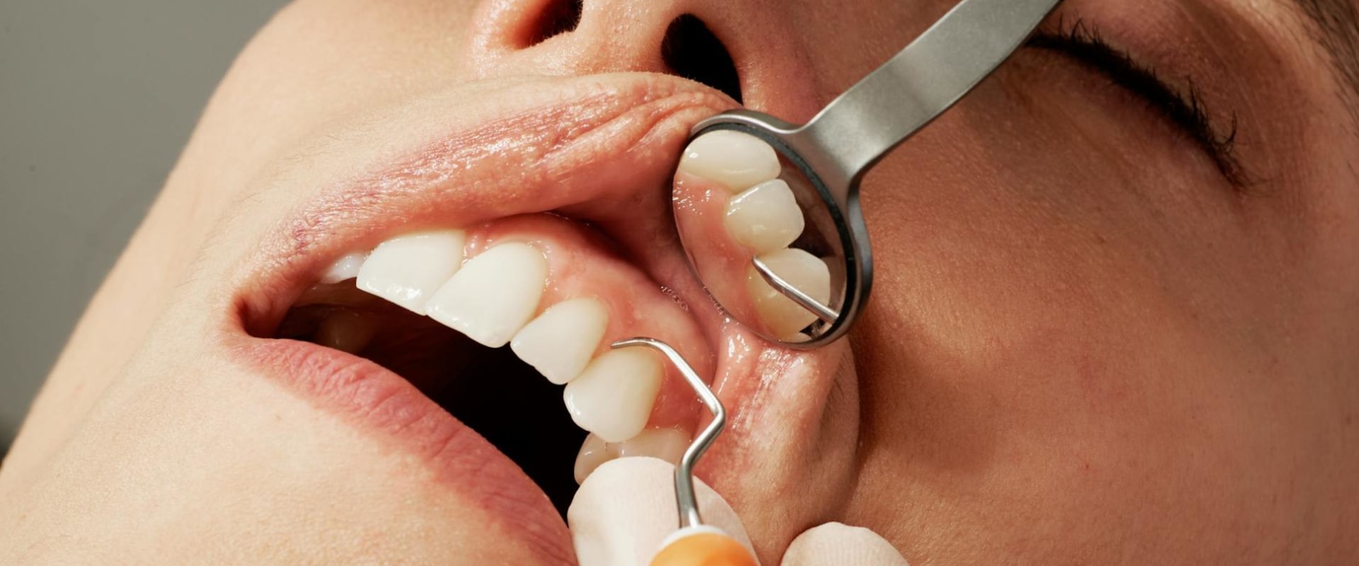 Basel Dentistry: Why Severe Tooth Pain Relief Requires More Than Just Dentistry Tools