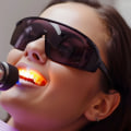 The Top Benefits of Choosing Dental Laser Cleaning Over Traditional Methods