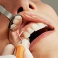 Basel Dentistry: Why Severe Tooth Pain Relief Requires More Than Just Dentistry Tools