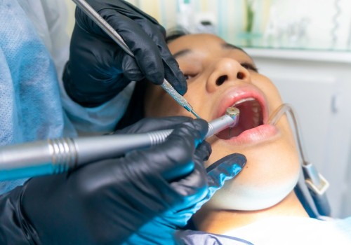 The Advantages of Utilizing Dental Curettes in Dentistry