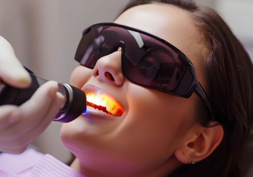 The Top Benefits of Choosing Dental Laser Cleaning Over Traditional Methods