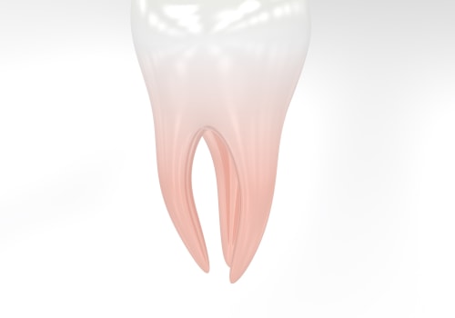 Understanding Dentistry Tools for Safe Impacted Tooth Removal