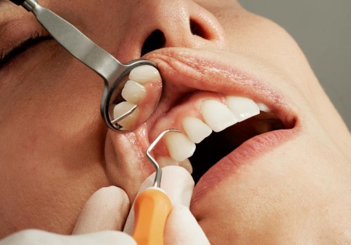 Basel Dentistry: Why Severe Tooth Pain Relief Requires More Than Just Dentistry Tools